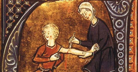 19 Bizarre Medical Practices From History That Sound Made Up – But Aren't