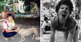 Her Parents Abandoned Her At The Age Of 3, But Wild Dogs Raised Her As Their Own Feral Child