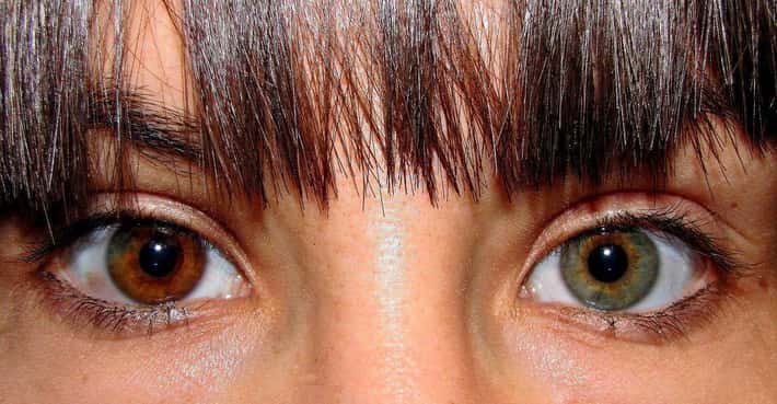 Heterochromia Iridium: Eyes in Different Colors