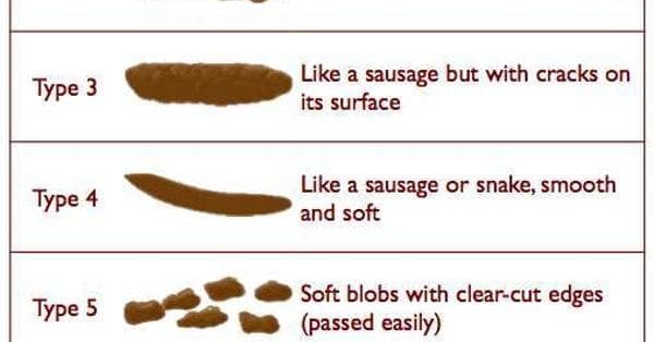 Lactose Intolerance Symptoms List of Signs of Lactose Intolerance