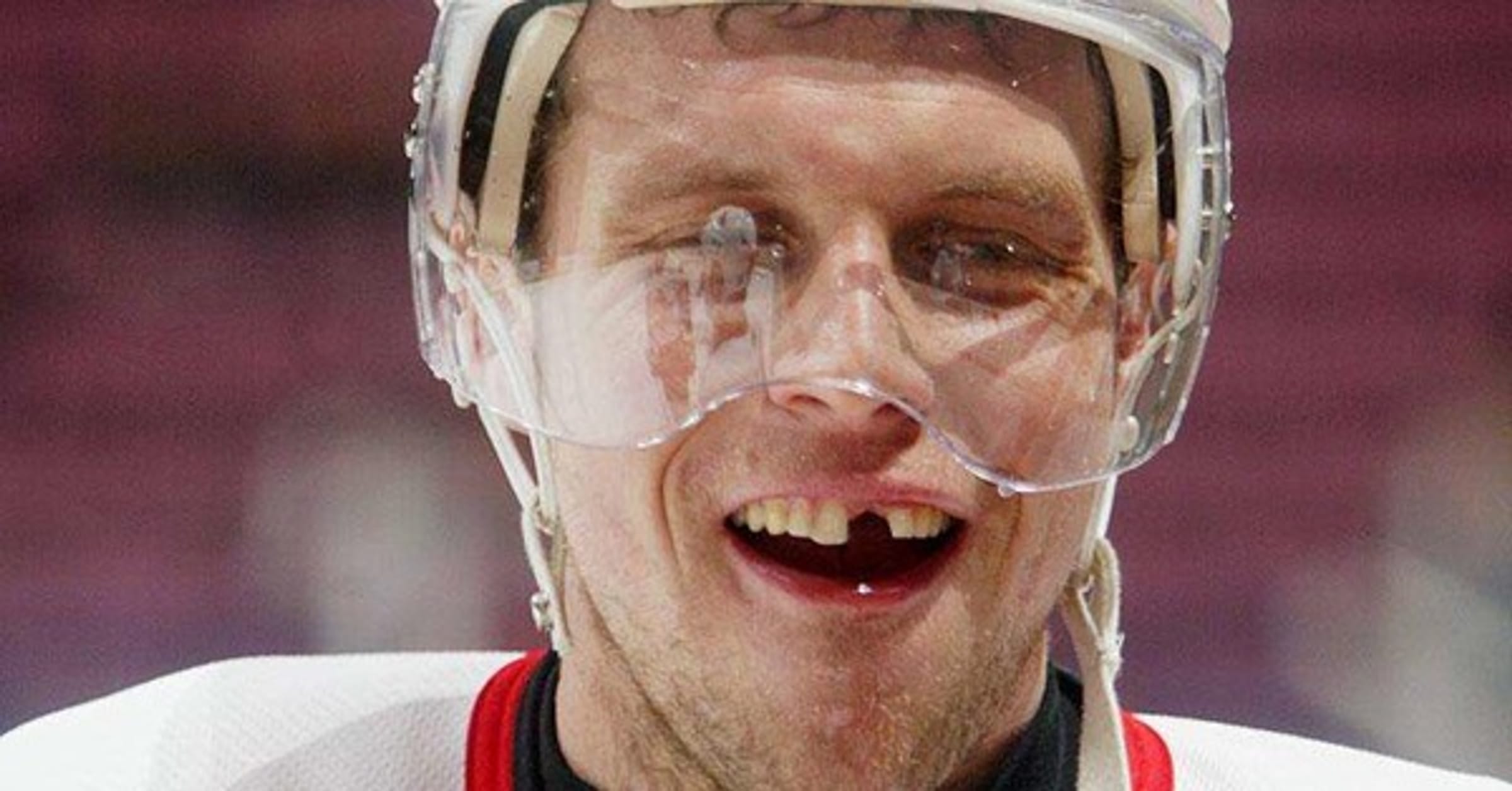 11 Hockey Players Who Lost Their Teeth Playing The Game They Love