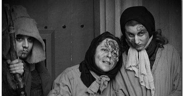 warning dr travel of Hidradenitis Suppurativa of Signs Symptoms   List