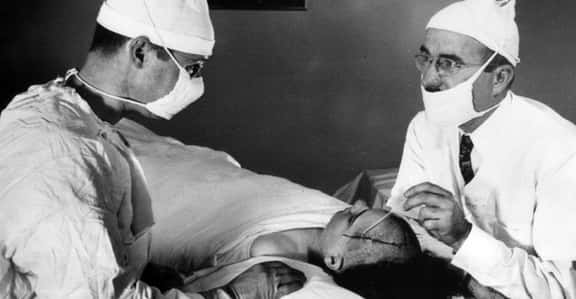 Early Lobotomy Surgeons Would Literally Pour Alcohol Onto Their Patients' Brains
