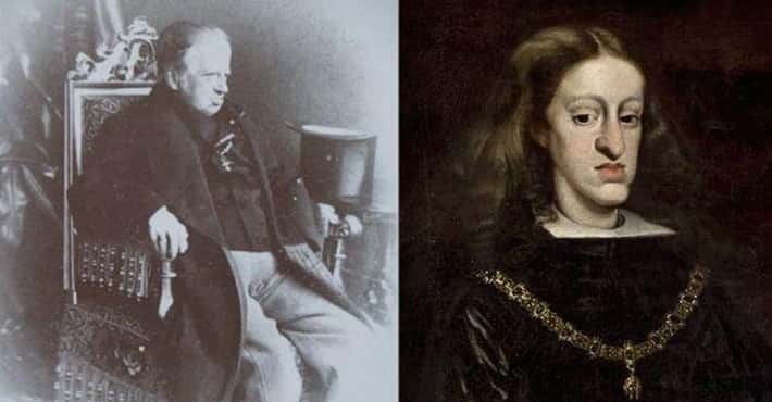 Royals Who Had Defects Caused by Inbreeding