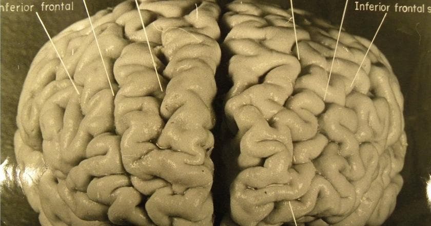 Historical Figures Whose Body Parts Went Missing for Strange Reasons