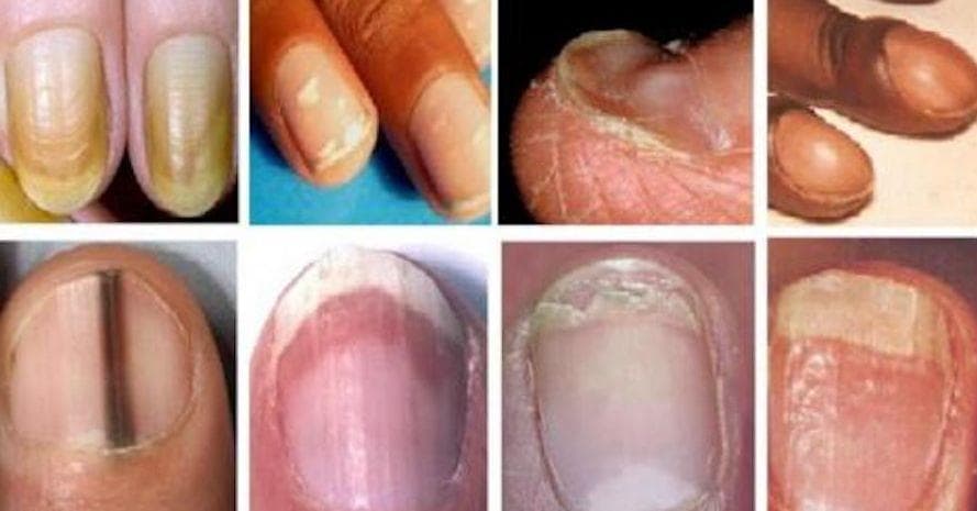 10 Surprising Reasons Why Humans Have Nails