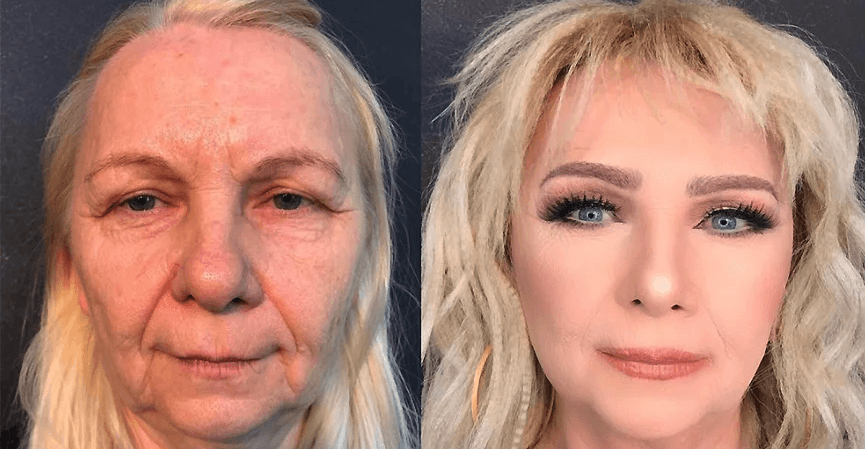 Ugly Makeup Transformation