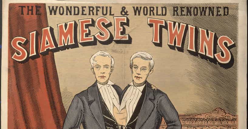 The Strange Lives Of Chang And Eng Bunker, The Original Siamese Twins
