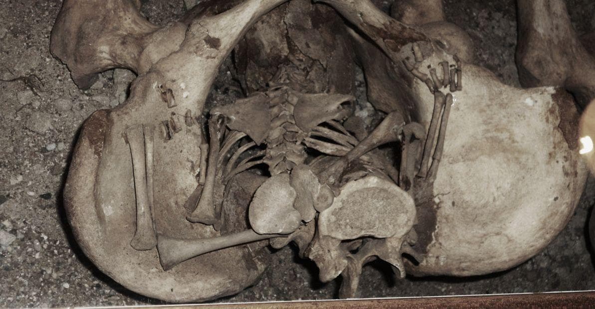 Un esqueleto de una madre y su bebé, quienes murieron durante su embarazo.