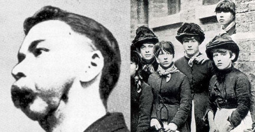 English Factory Laborers Were Forced To Work With Toxic Chemicals Until Their Faces Became Deformed