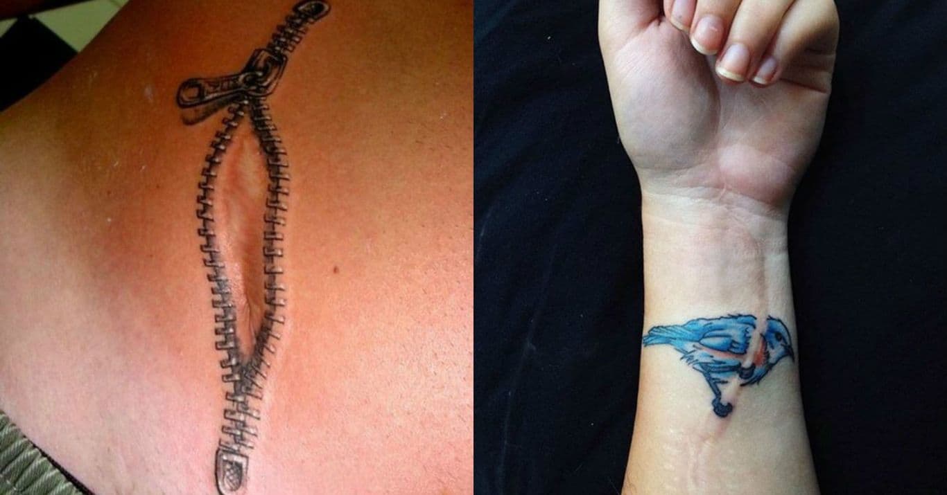 29 Amazing Scar Cover Up Tattoos That Will Blow You Away   Scar Tattoos U4