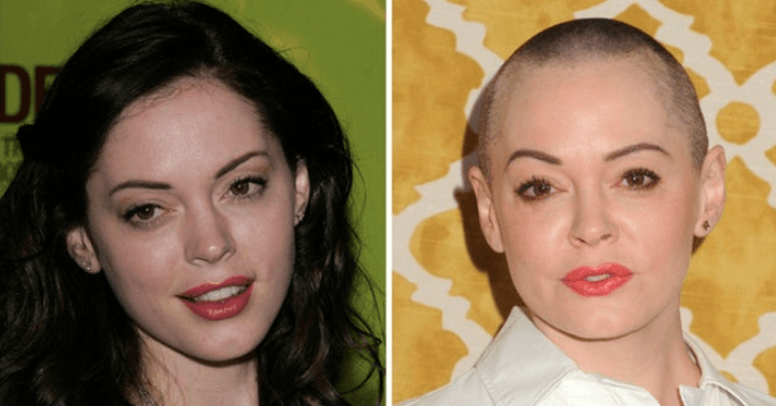 15 Celebrities Whose Faces Have Changed The Most Over Time