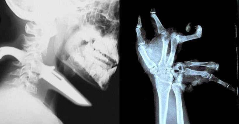 xray pictures