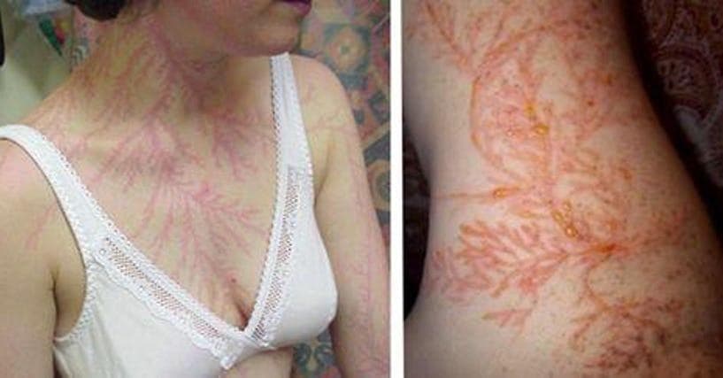 What Happens To Your Body When You re Hit By Lightning Page 2 