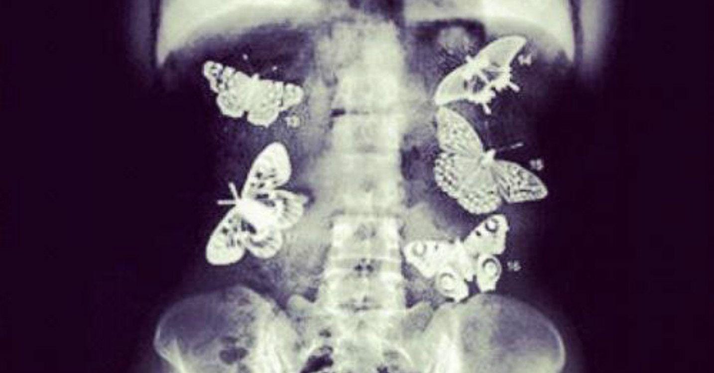 Scientific Reasons You Feel Butterflies in Your Stomach