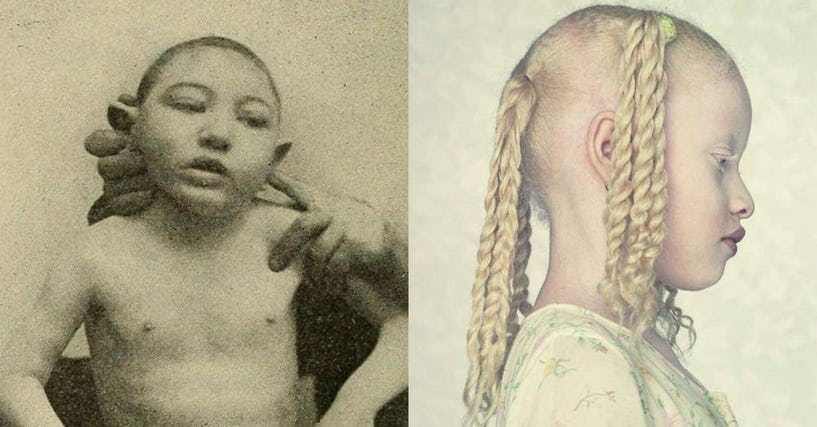 Инбридинг у людей последствия фото 13 Genetic Mutations That Can Arise from Incest