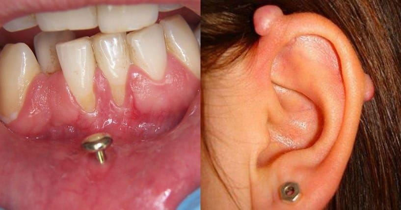 17 Terrifying Side Effects Of Body Piercings