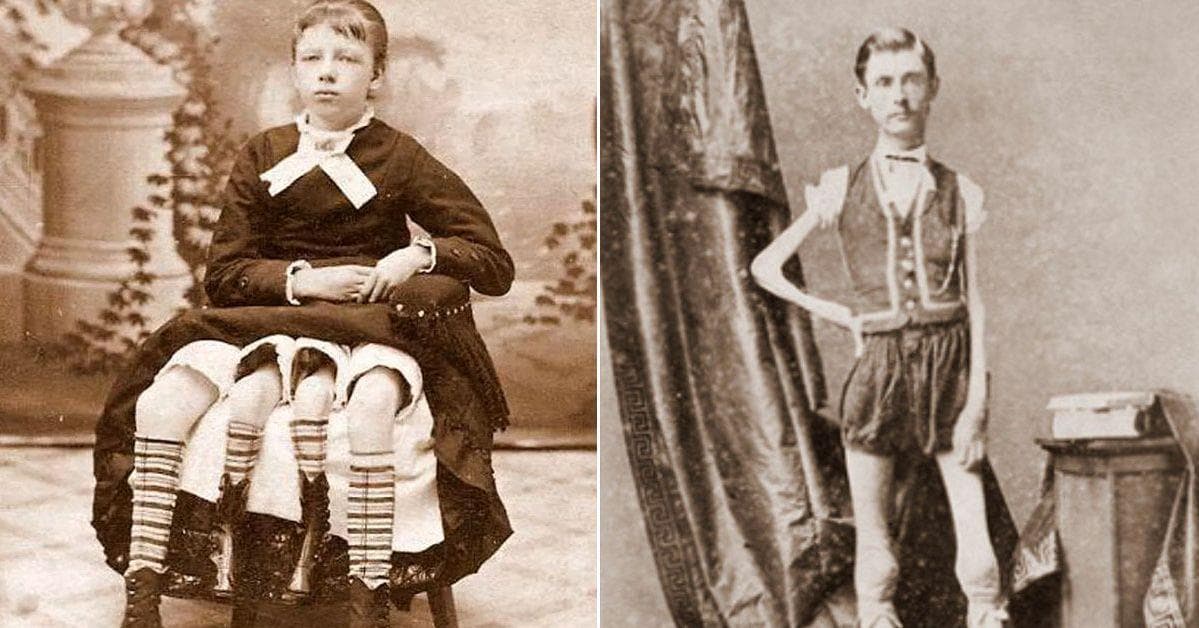 Every Single "Human Attraction" From P.T. Barnum's "Freak Show"