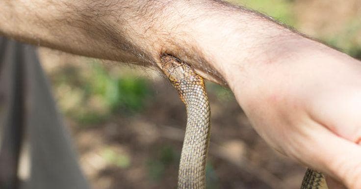 10 Snake Bites You Should Never Look At On Google Images