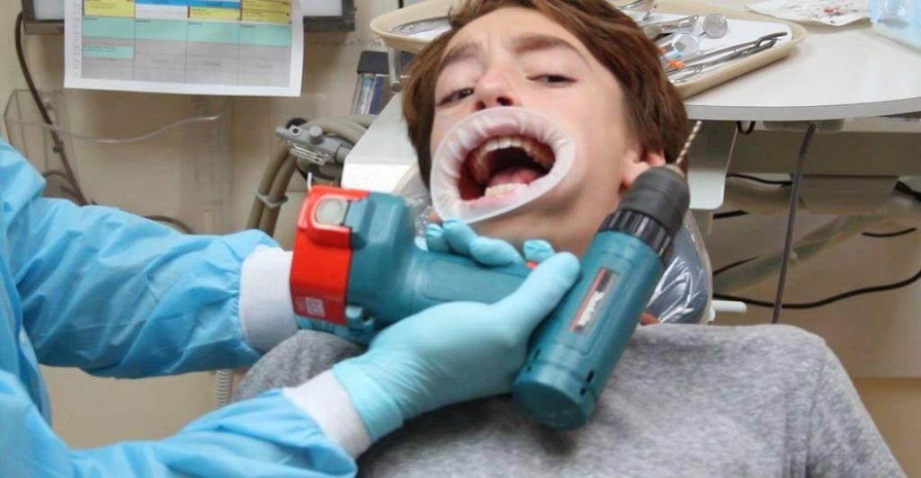 Worst Wisdom Teeth Removal Stories Of All Time