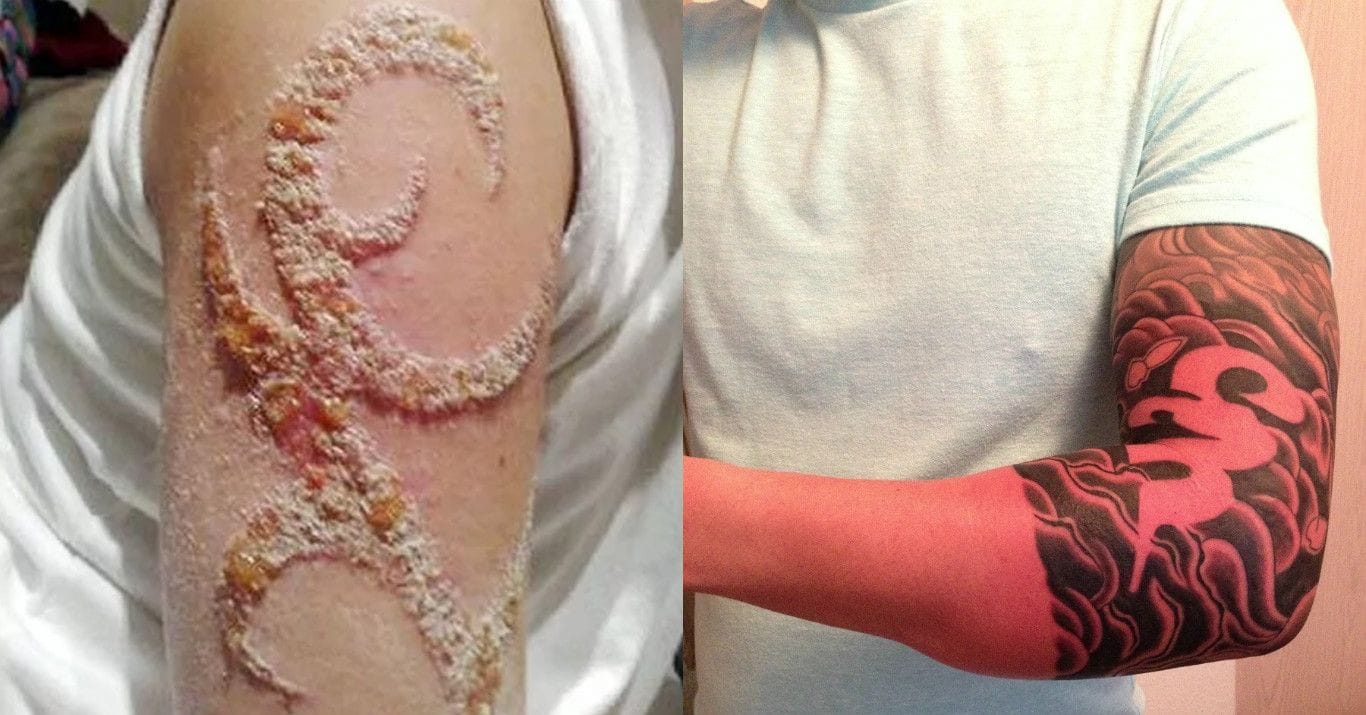 13 Awful Tattoo Side Effects