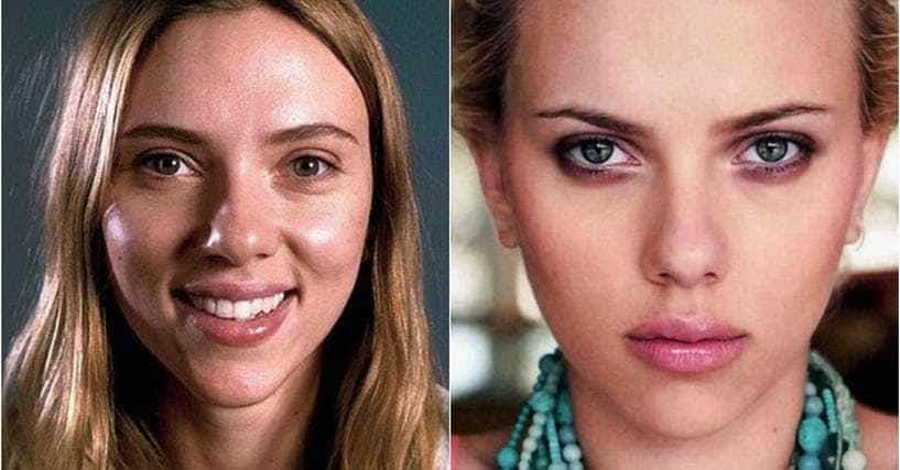Celebrity Nose Jobs: Before and After