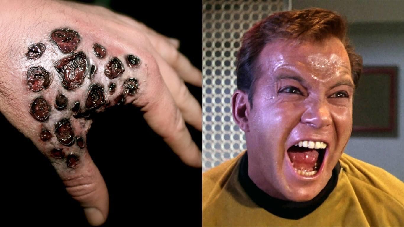 Grossest Things That Can Grow On Your Body | List Of Gross Diseases