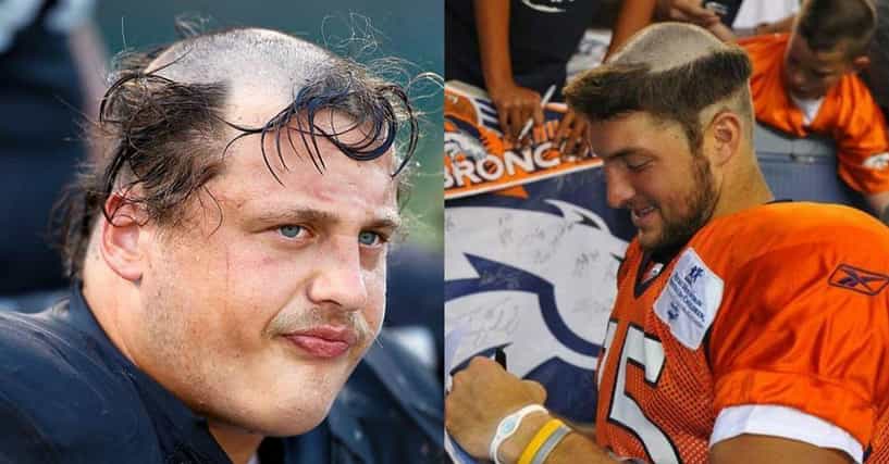 Worst Hair in NFL History: Football Players with Horrible 