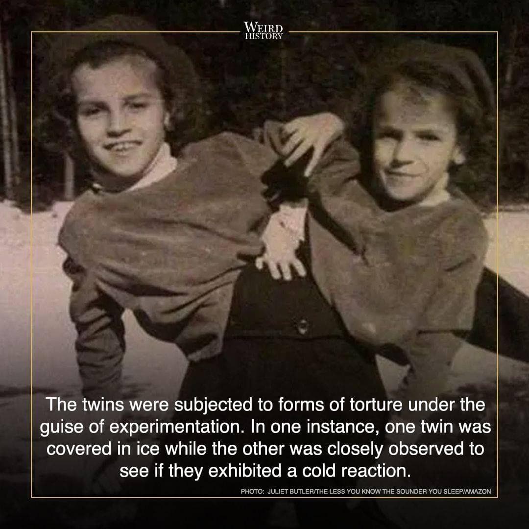 Things Most People Don T Know About Conjoined Sisters Abby And Brittany