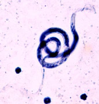 12 Crazy Parasite Life Cycles That Are Truly Bizarre