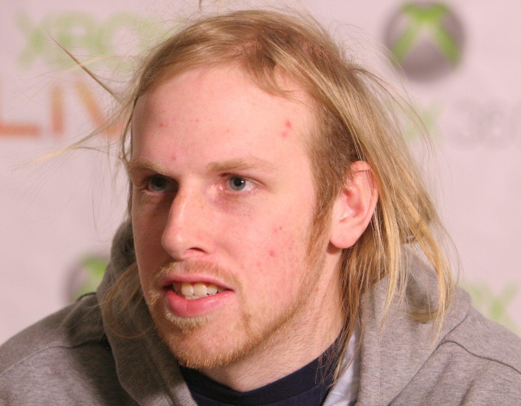 Worst Hairstyles in the NBA Basketball Stars with Horrible Haircuts