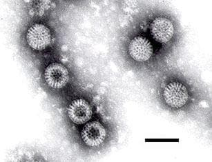 Random Scariest Viruses on Earth Today