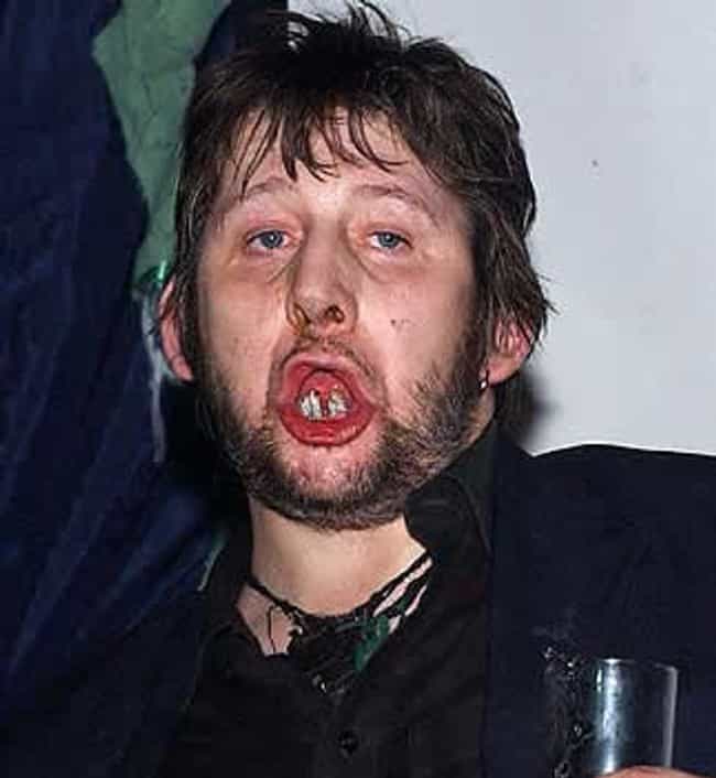 WHO IS WHO - Página 2 Shane-macgowan-recording-artists-and-groups-photo-u1?w=650&q=50&fm=pjpg&fit=crop&crop=faces