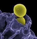 Staphylococcus aureus on Random Most Dangerous Drug-Resistant Diseases