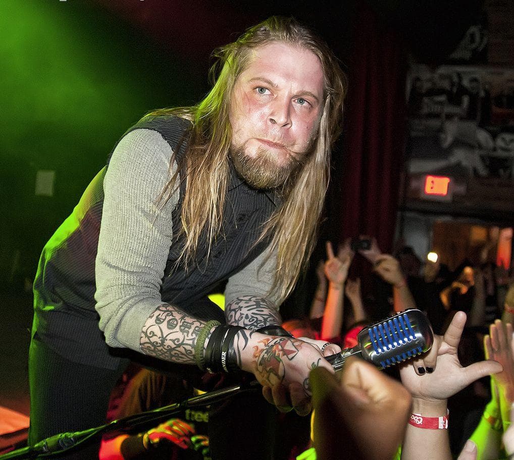 Celebrities with Bell's Palsy