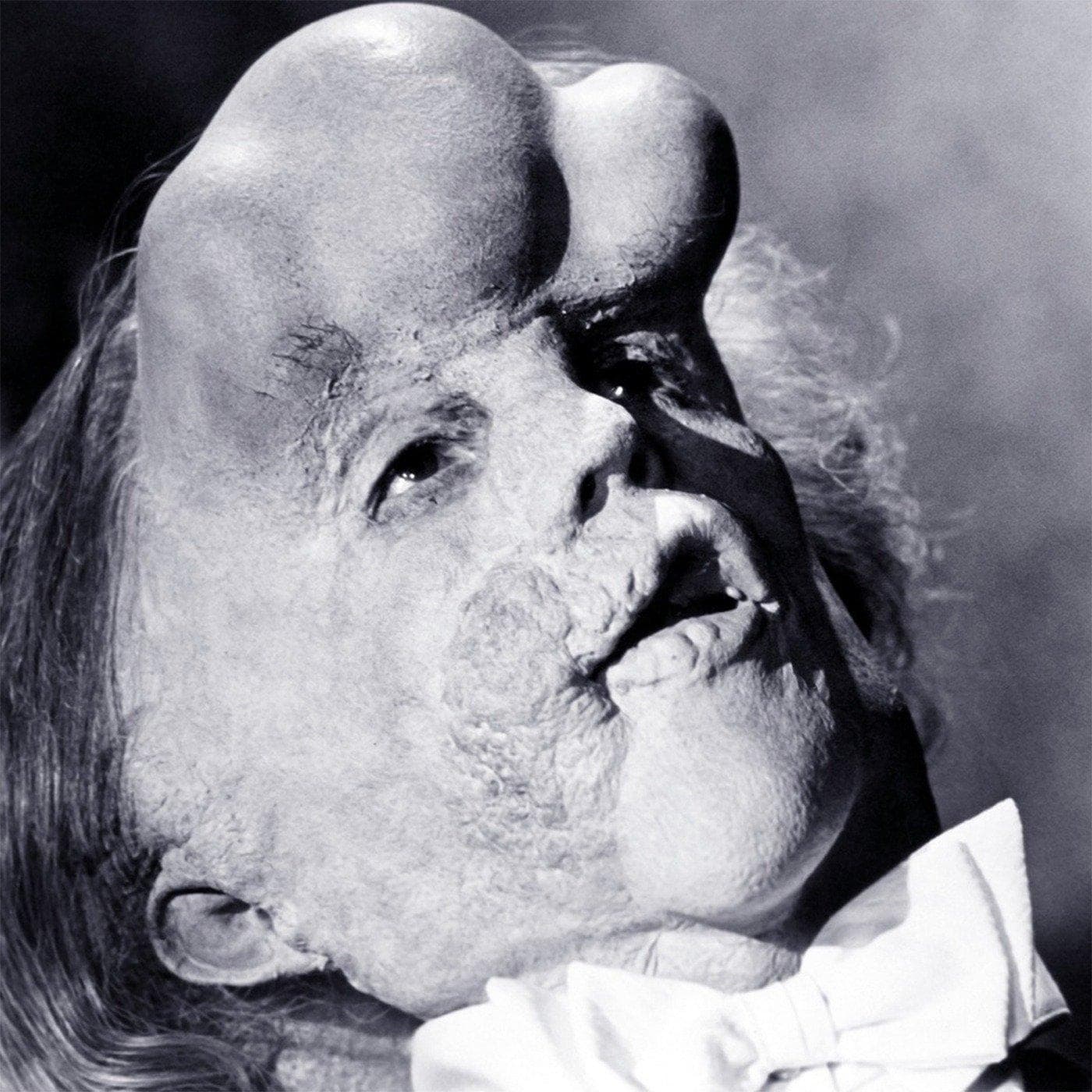 The Elephant Man