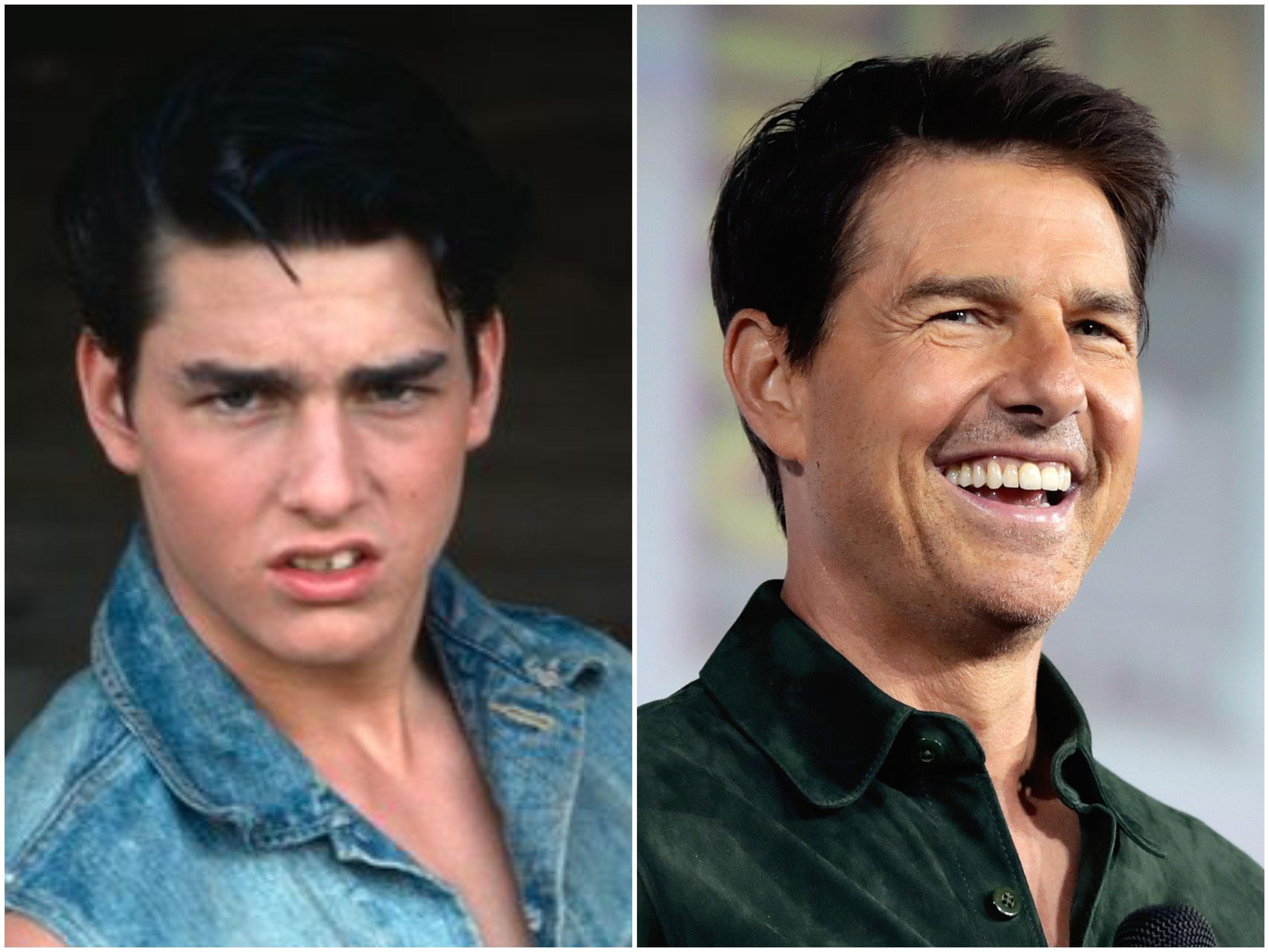 What Famously Hot Celebrities Looked Like Before They Got Their Hollywood  Makeovers