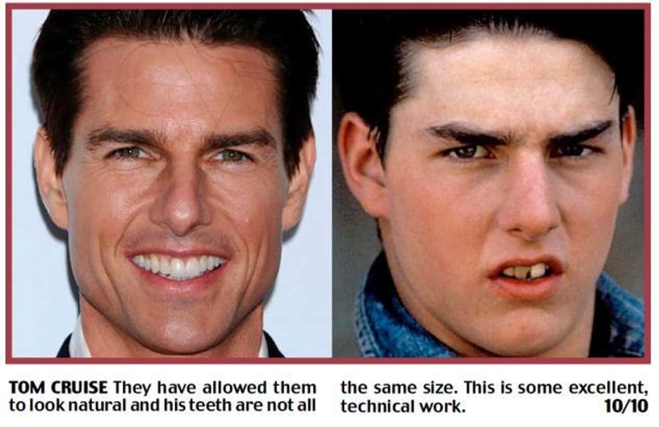 How to get pearly white teeth