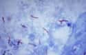 Tuberculosis on Random Most Dangerous Drug-Resistant Diseases