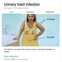 Urinary tract infection on Random Weird Medical Drawings Google Thinks You Need