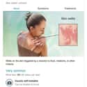 Urticaria on Random Weird Medical Drawings Google Thinks You Need