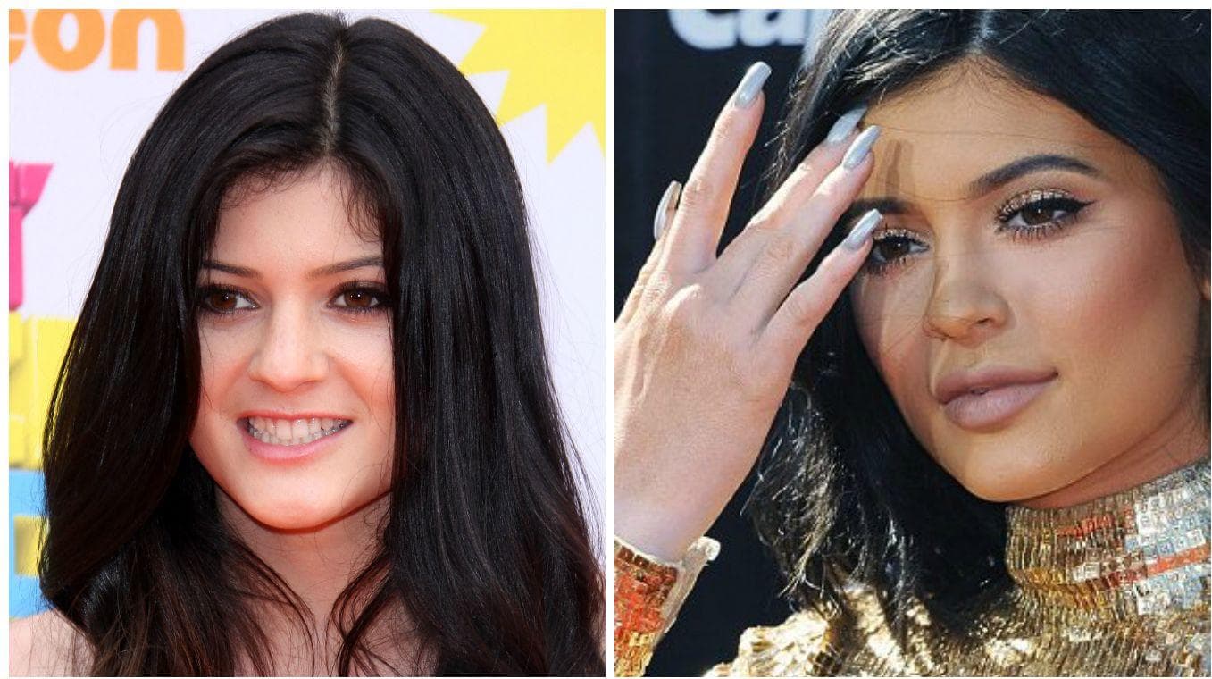 17 Celebrities Whose Faces Have Changed the Most Over Time