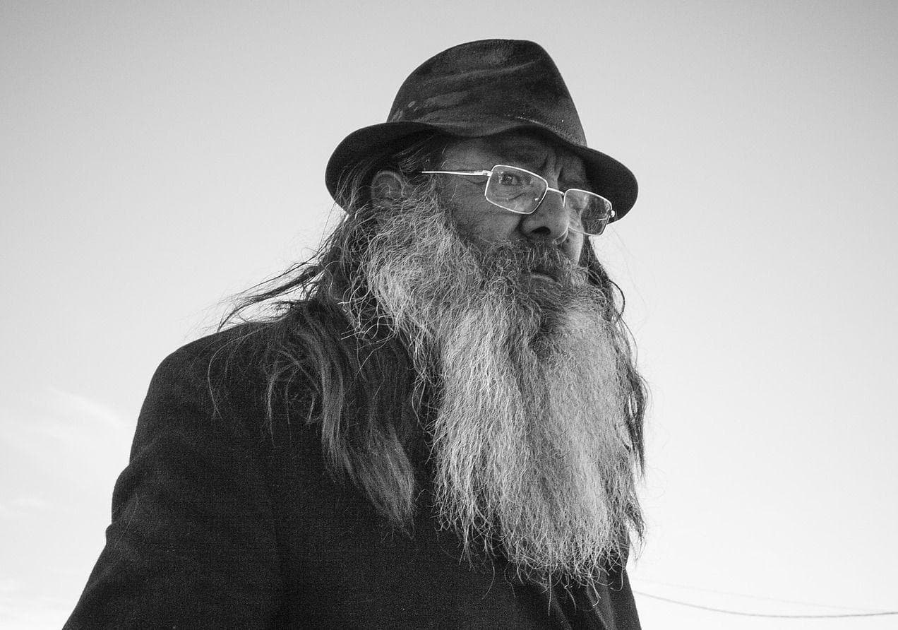 Surprising Traits You Didn't Know Were Vestigial