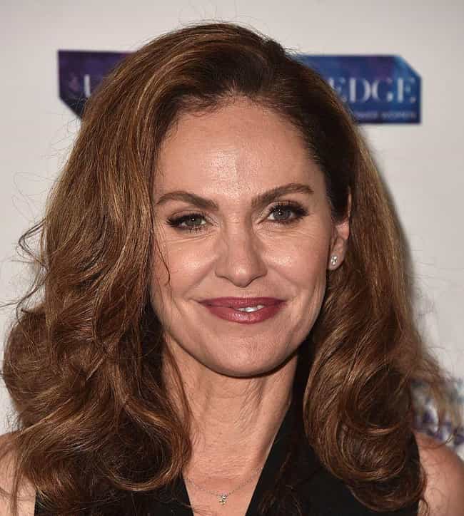 Celebrities with Bell s Palsy Page 3 Celebrities with Bell s Palsy Page 3