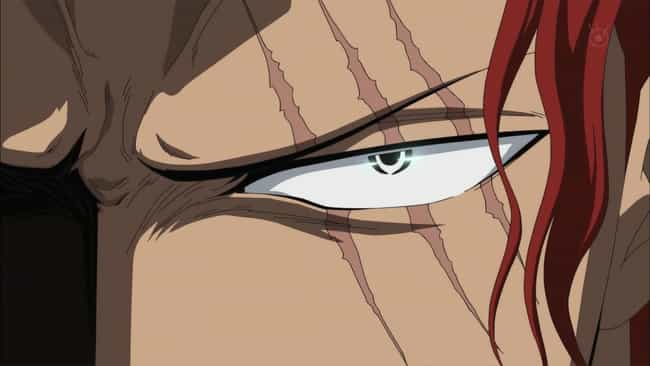 Shanks