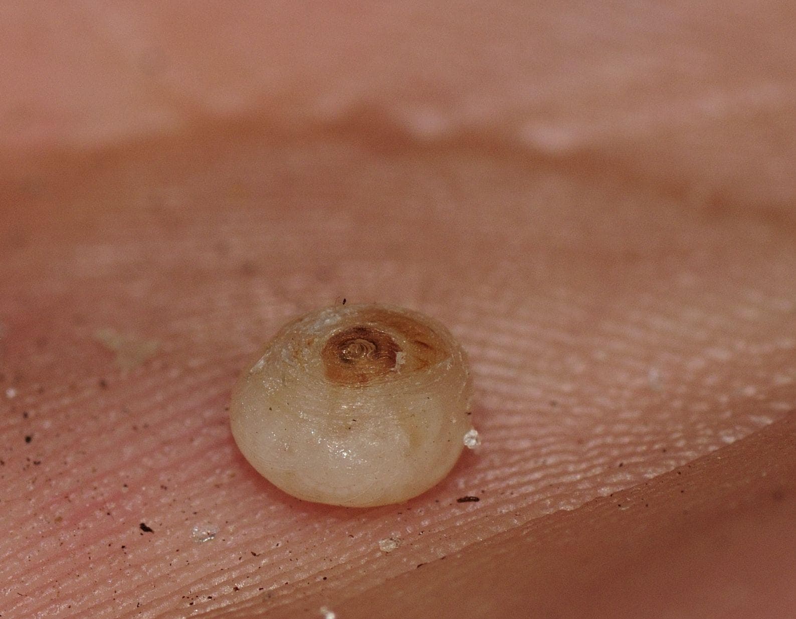 Here Are All Of The Insects That Love To Feed Off Of Human Flesh