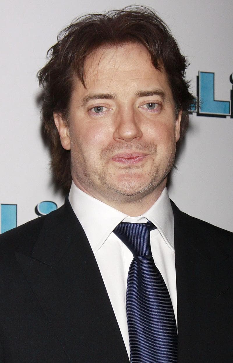 Celebrities with Hair Transplants | List of Famous Men with Plugs (Page 3)