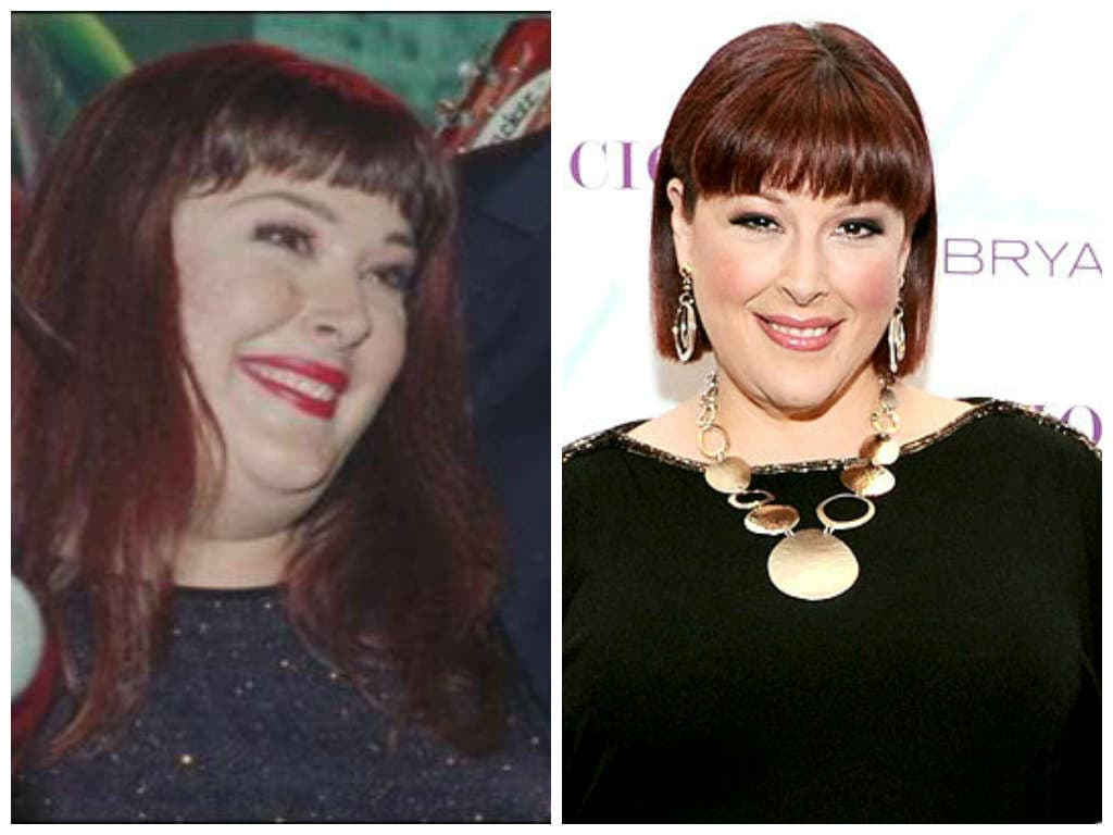 35+ Celebrities Who Had Weight Loss Surgery