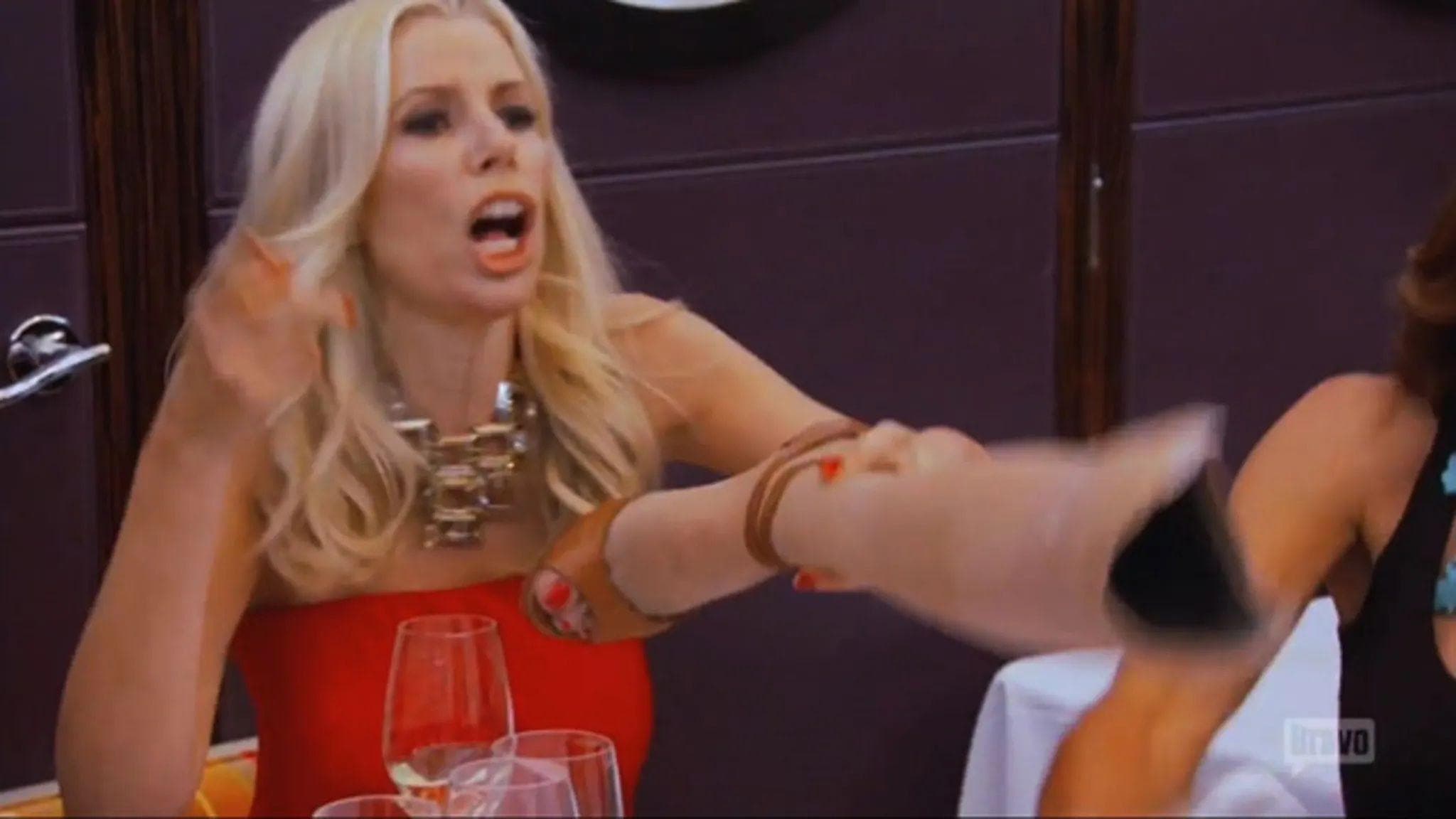 'The Real Housewives of New York City' - Aviva Puts Her Prosthetic Leg On The Dinner Table