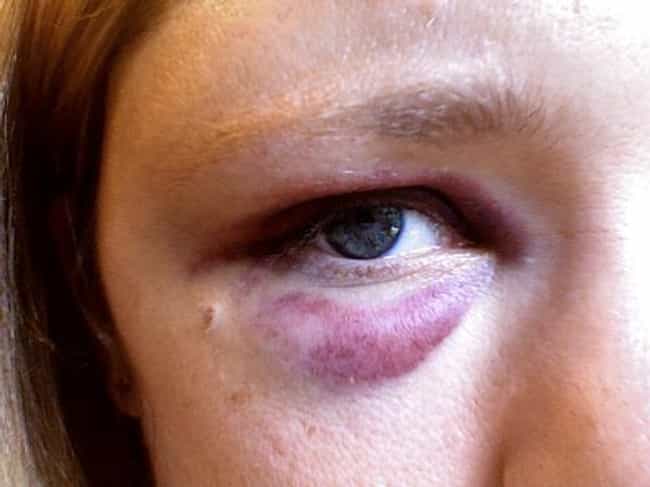 What do you tell a woman with two black eyes?